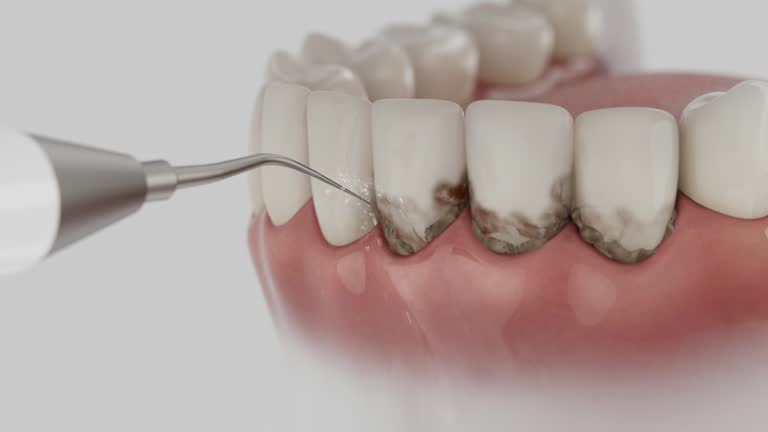 Reliable Dental Implants contractor in Ferndale, MD by Smile Center Dentistry